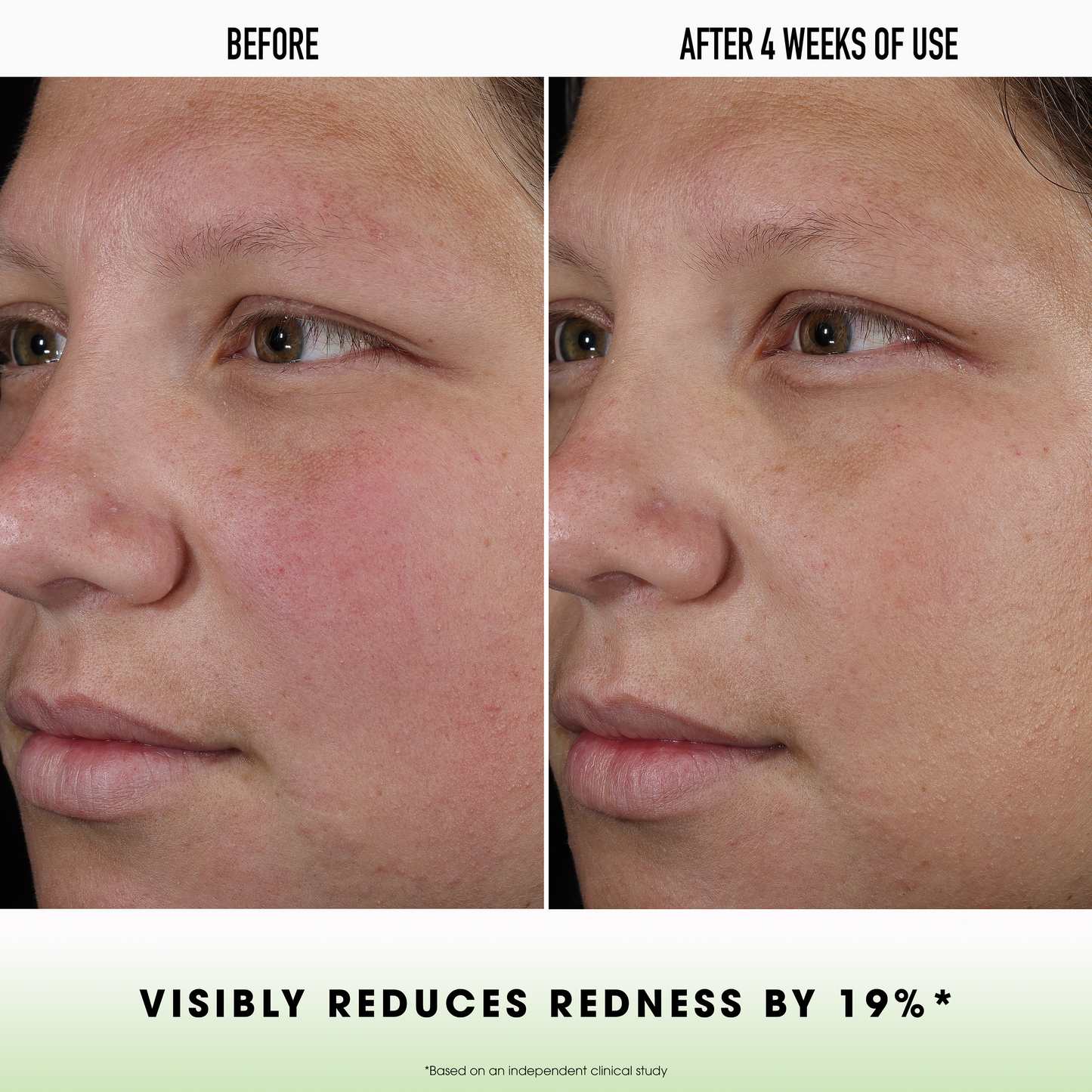 SKINLONGEVITY® Hydration Haven Gel Cream